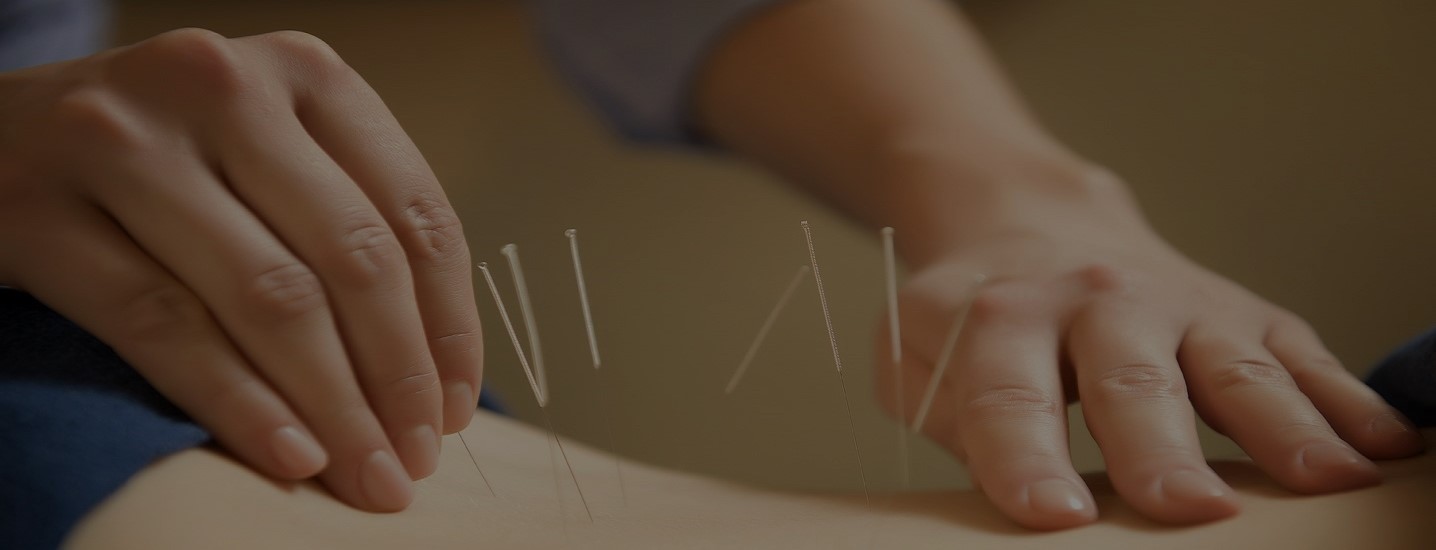 Acupuncture at Hospice West Auckland